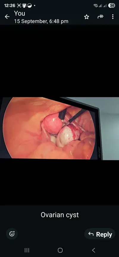 Laparoscopic surgery 